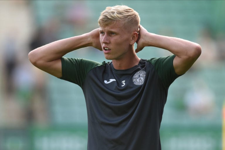 EDINBURGH, SCOTLAND - JULY 22: Josh Doig of Hibernian FC before the UEFA Conference League second qualifying round first leg match between Hibernia...