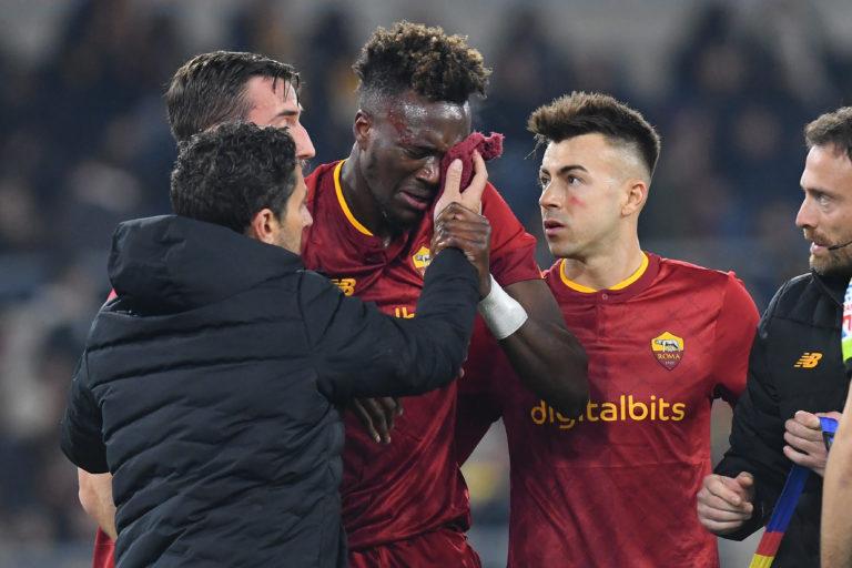 Photo by Massimo Insabato ATPImages/Getty Images